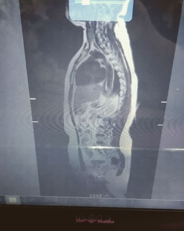 This came with my MRI report. Interesting right? (Trying to figure out the visceral fat part.)